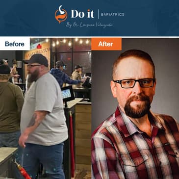 Slider image (4) Do It Bariatrics